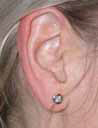 Foto eines Ohres mit einem Ohrring